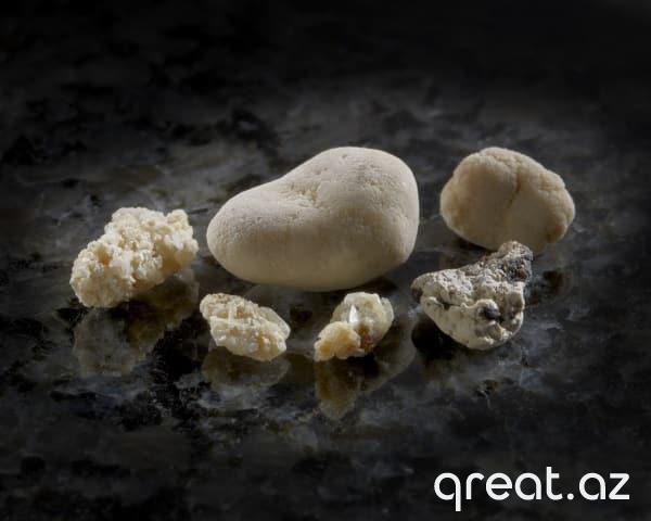 Böyrək Daşlarının Qarşısını Almaq: Ətraflı Bələdçi