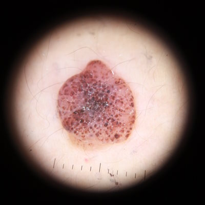 Xallar və Onların Mənası: Dərindən Baxış Xallar və Onların Mənası: Dərindən Baxış