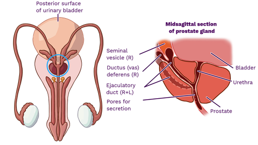Kişilərdə Xroniki Prostatit: Müasir Müalicə Metodları və Effektiv Həllər