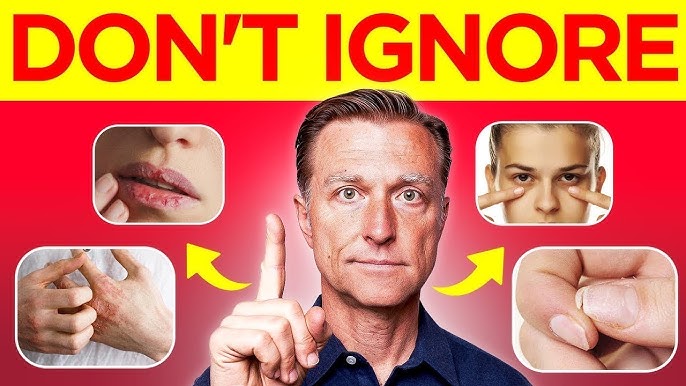 Vitamin Çatışmazlığını Göstərən 5 Fizikİ Əlamət: Sağlamlığınızdan Xəbər Verən Bədən Siqnalları